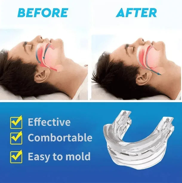 Anti Snoring Bruxism Mouth Guard Teeth Bruxism Sleeping Apnea Guard Anti Snore Mouthpiece Snoring Device To Stop Snoring