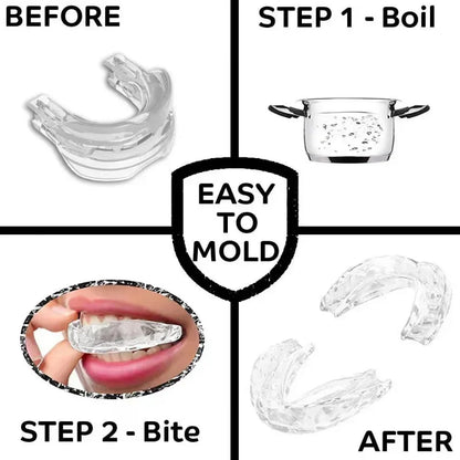 Anti Snoring Bruxism Mouth Guard Teeth Bruxism Sleeping Apnea Guard Anti Snore Mouthpiece Snoring Device To Stop Snoring